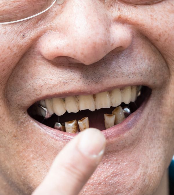 5 Reasons Why You Need Restorative Dentistry CR Dental